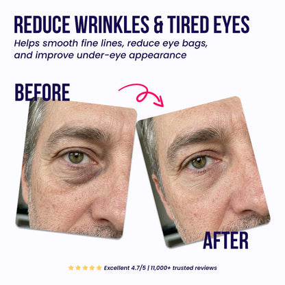 Under-Eye Repair Patches for Men