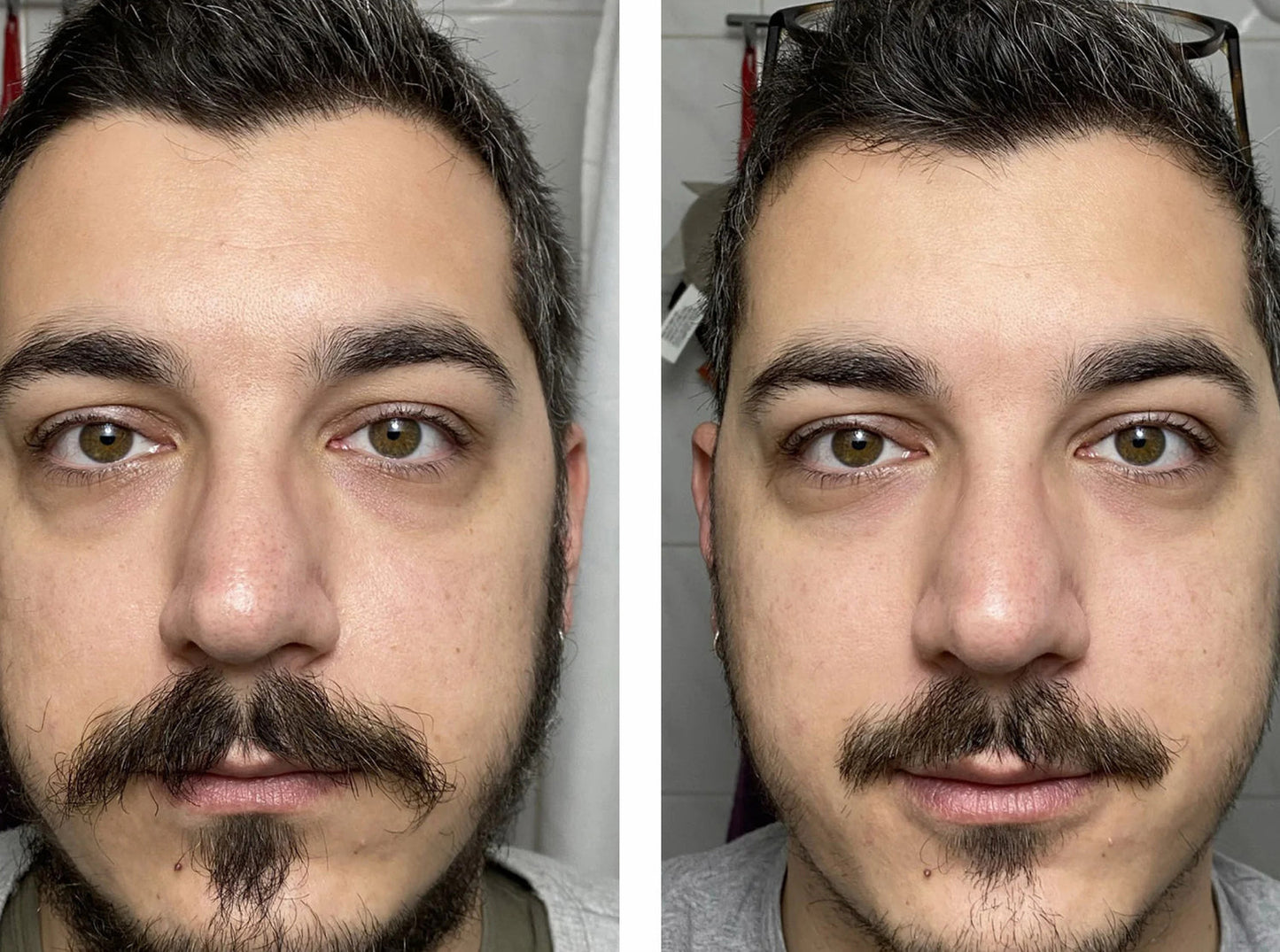 Under-Eye Repair Patches for Men