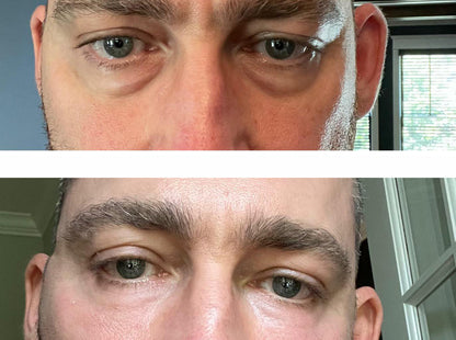 Under-Eye Repair Patches for Men