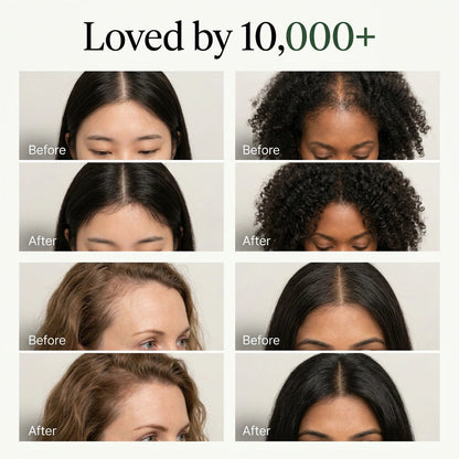 Kovy Korean Scalp Revival Bar