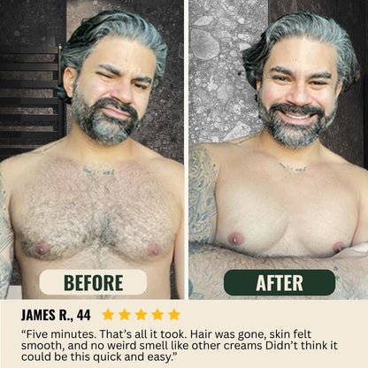 KOVY™ Hair Removal Cream for Men